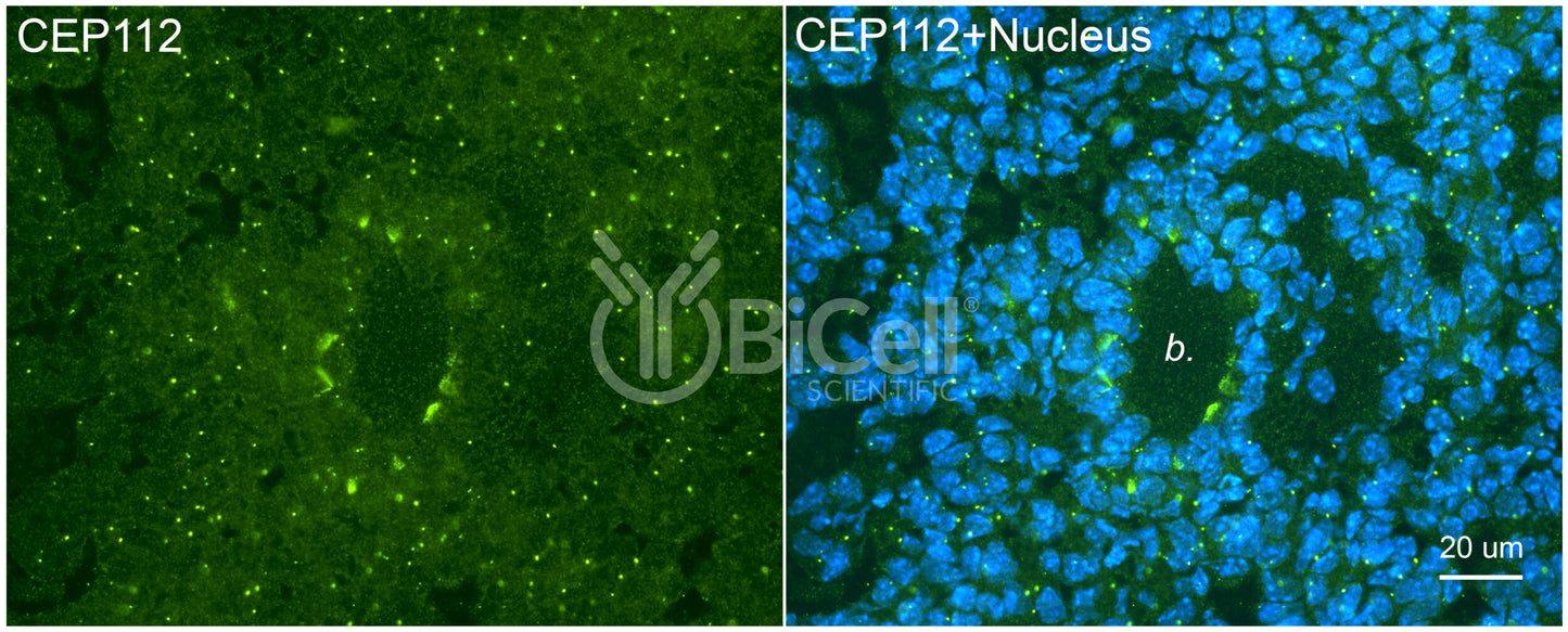 CEP112 (CCDC46) Antibody