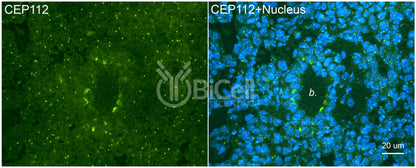 CEP112 (CCDC46) Antibody