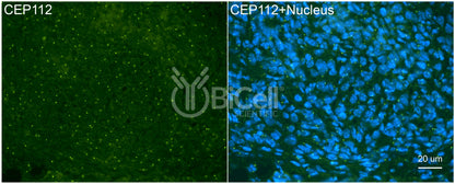 CEP112 (CCDC46) Antibody