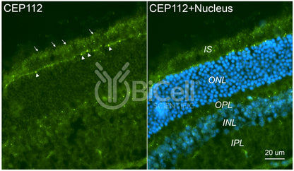 CEP112 (CCDC46) Antibody - FFPE Validated