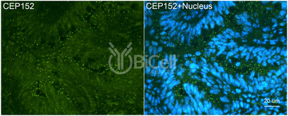 CEP152 Antibody - Western Blot Validated