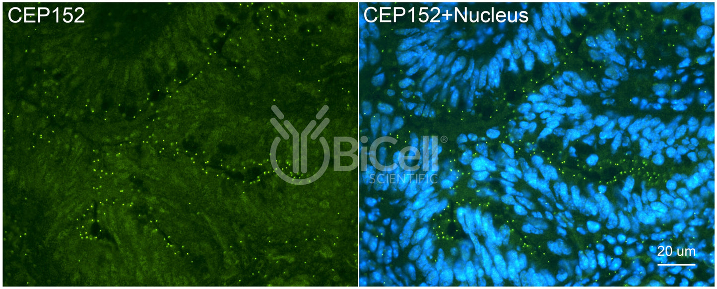 CEP152 Antibody