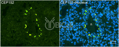 CEP152 Antibody