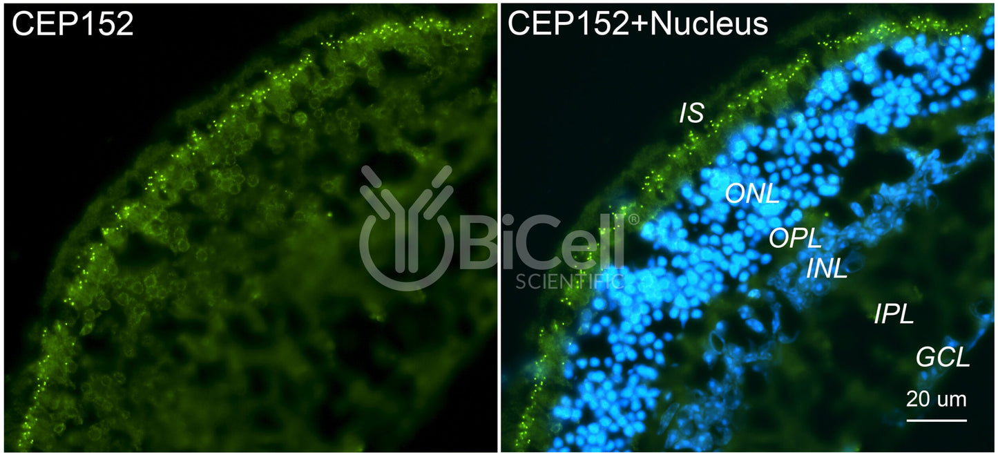 CEP152 Antibody