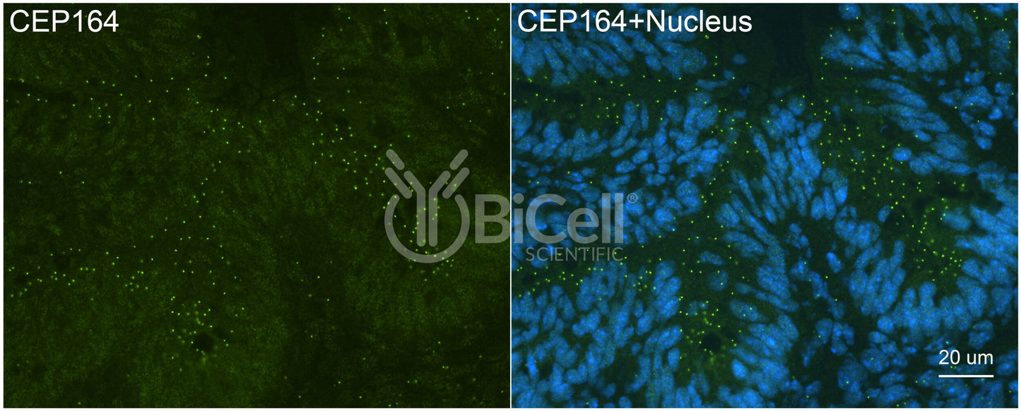 CEP164 (NPHP15) Antibody - Western Blot Validated