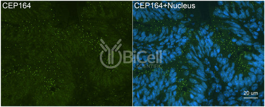 CEP164 (NPHP15) Antibody