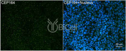 CEP164 (NPHP15) Antibody - Western Blot Validated