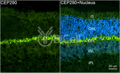 Nephrocystin-6 (NPHP6 or CEP290 or MKS4 or BBS14) Antibody - FFPE Validated