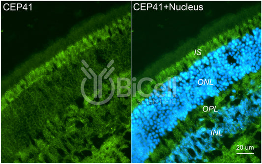 CEP41 (TSGA14) Antibody