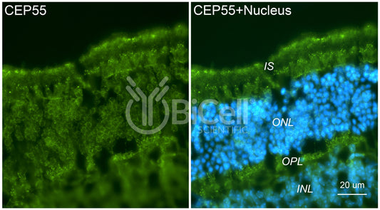 CEP55 Antibody