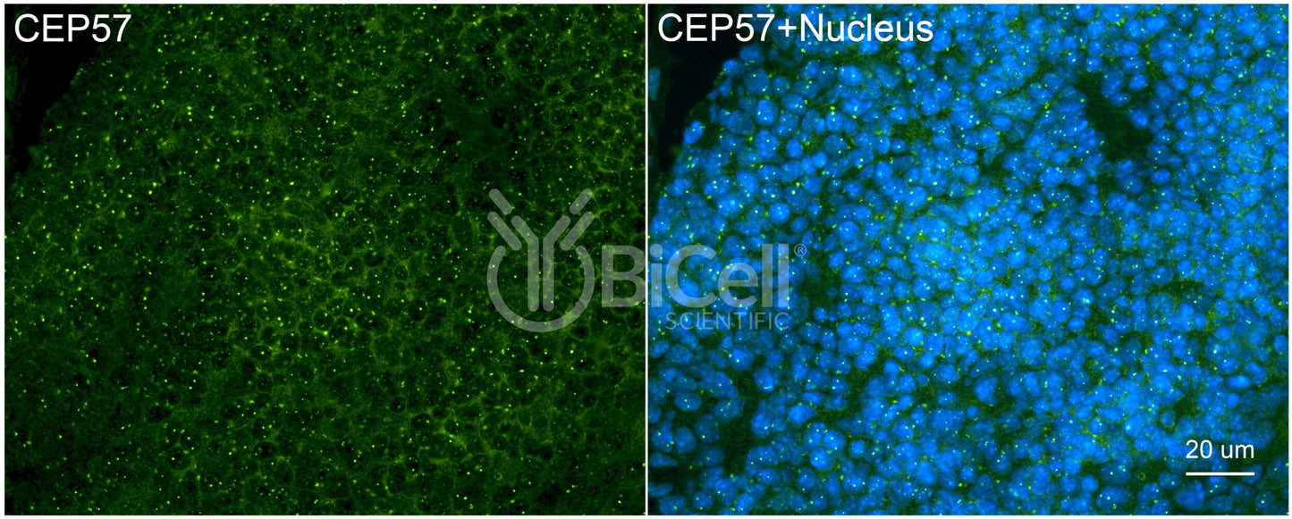 CEP57 Antibody - Western Blot Validated