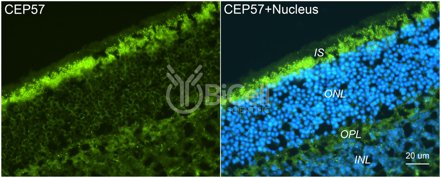 CEP57 Antibody - Western Blot Validated