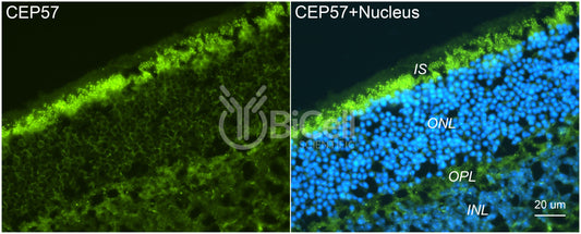 CEP57 Antibody