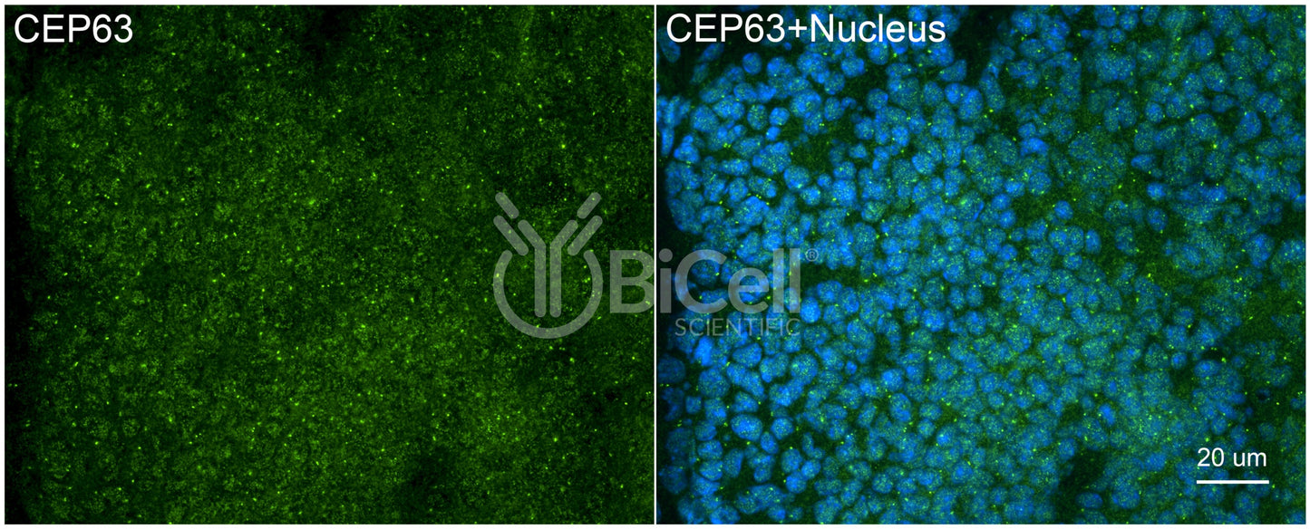 CEP63 Antibody