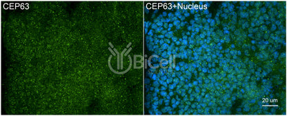 CEP63 Antibody