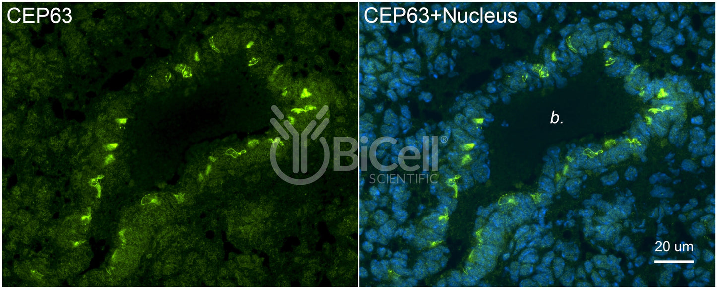 CEP63 Antibody