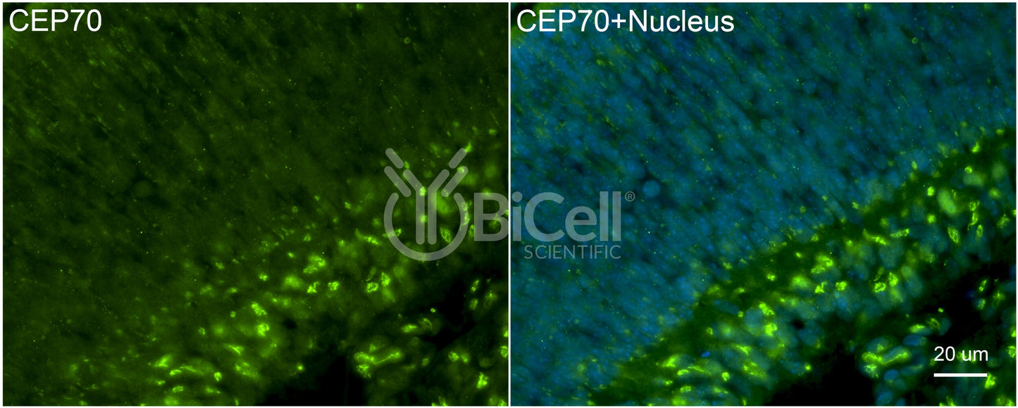CEP70 Antibody - Western Blot Validated
