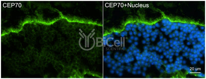CEP70 Antibody - Western Blot Validated