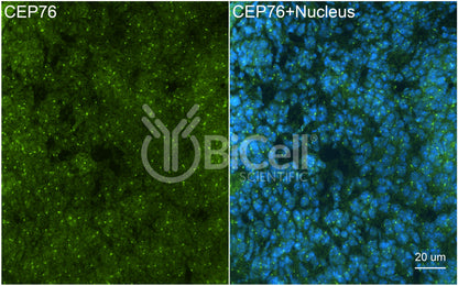 CEP76 Antibody - Western Blot Validated