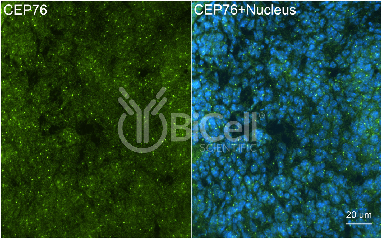 CEP76 Antibody