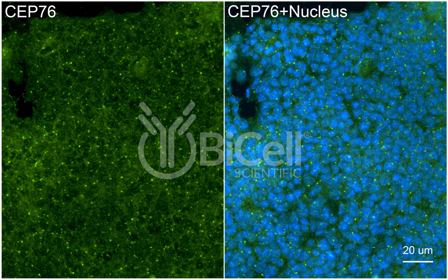 CEP76 Antibody - Western Blot Validated