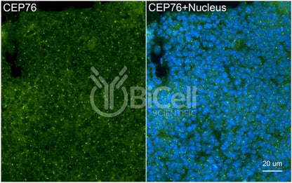 CEP76 Antibody - Western Blot Validated