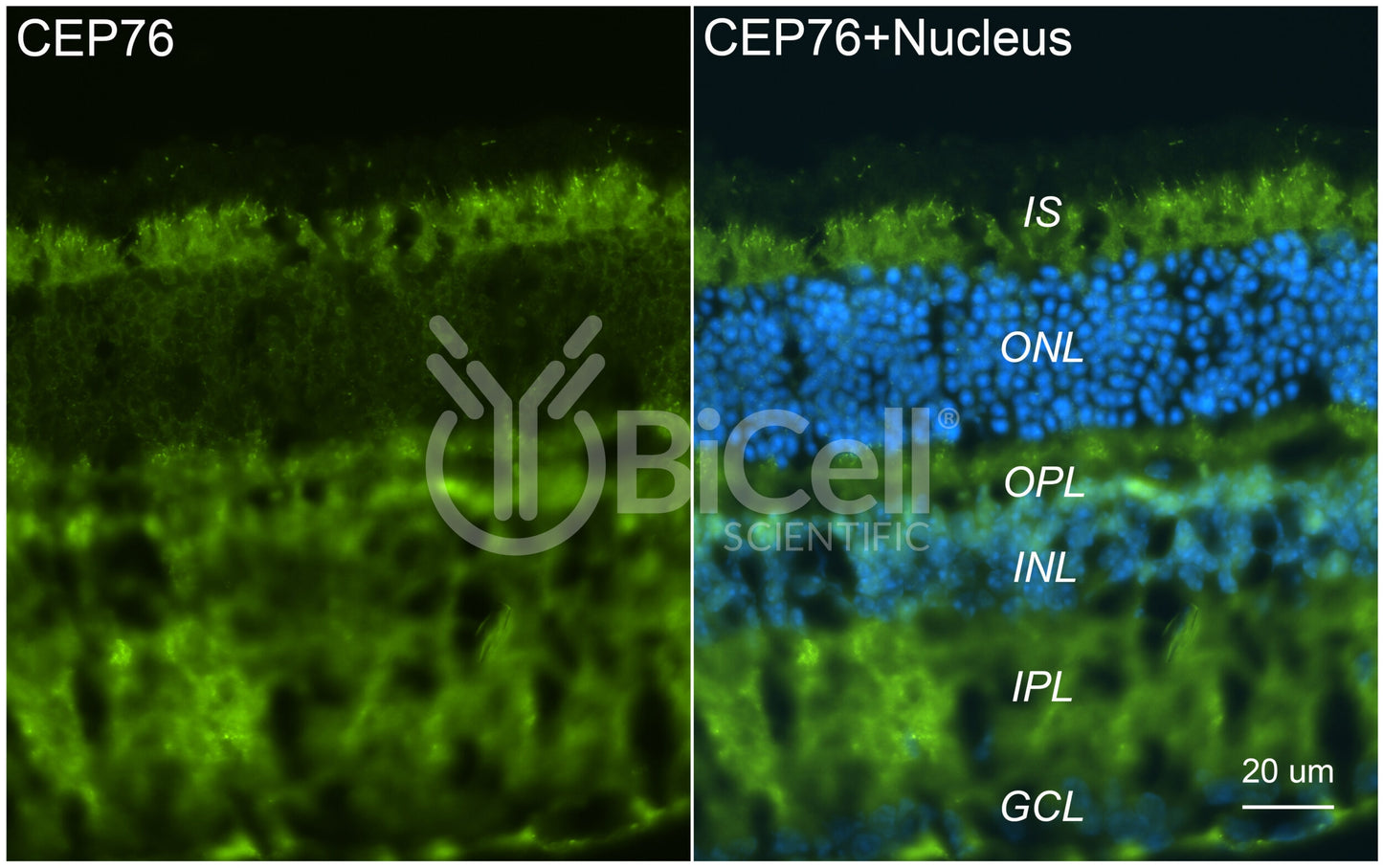 CEP76 Antibody - Western Blot Validated