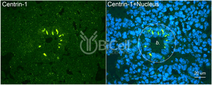 Centrin-1 Antibody - FFPE Validated