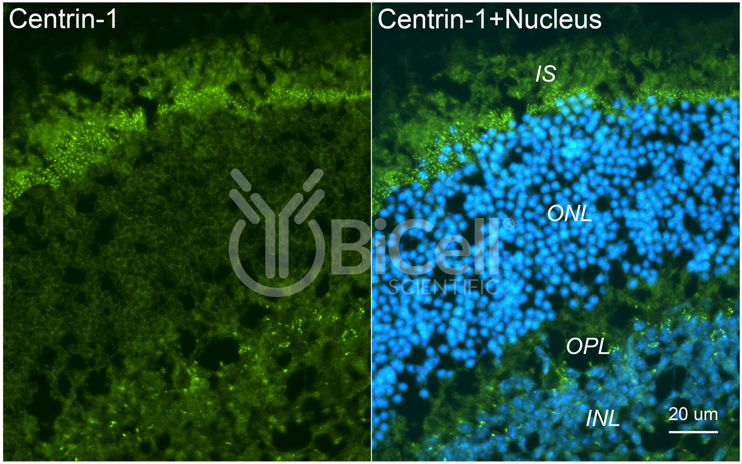 Centrin-1 Antibody - FFPE Validated