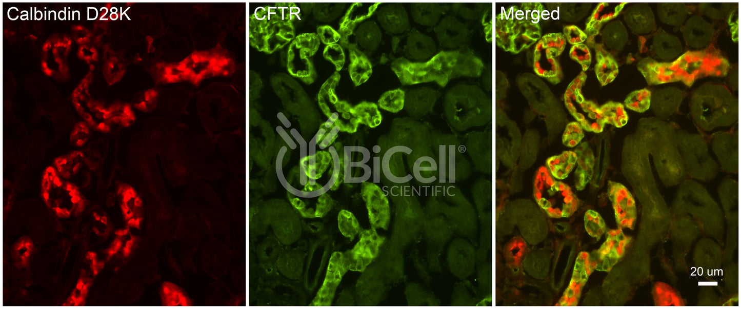 CFTR Antibody - Western Blot Validated