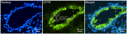 CFTR Antibody - Western Blot Validated
