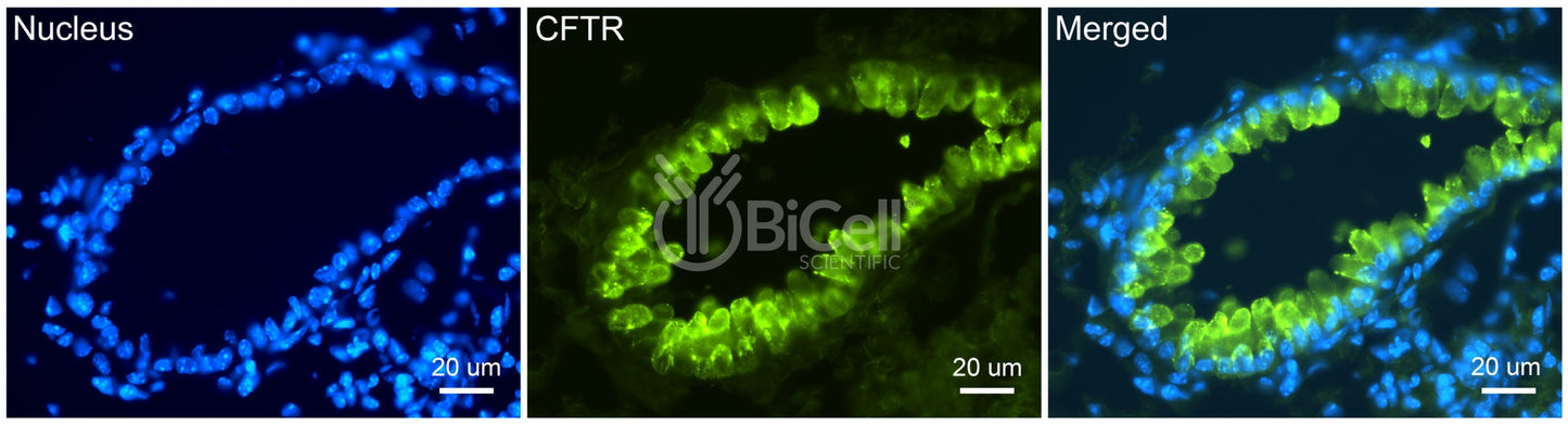 CFTR Antibody