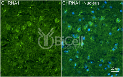 CHRNA1 (ACHRA) Antibody