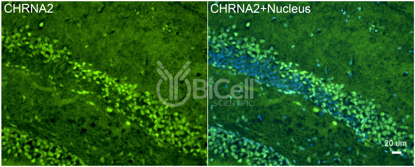 CHRNA2 Antibody - FFPE Validated