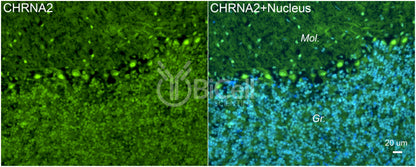 CHRNA2 Antibody