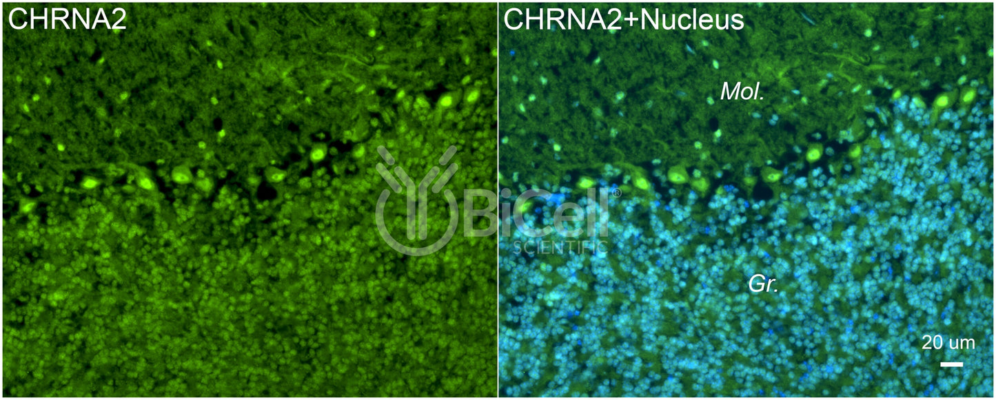 CHRNA2 Antibody - FFPE Validated