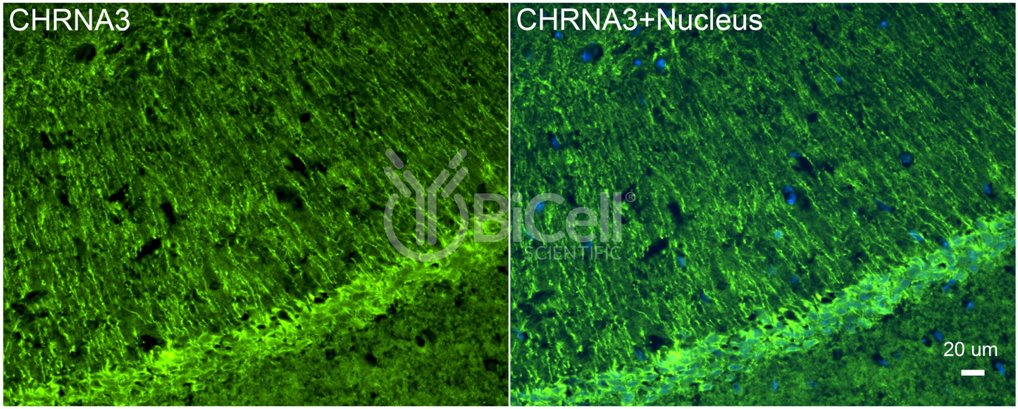 CHRNA3 (NACHRA3) Antibody - Western Blot Validated