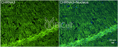 CHRNA3 (NACHRA3) Antibody
