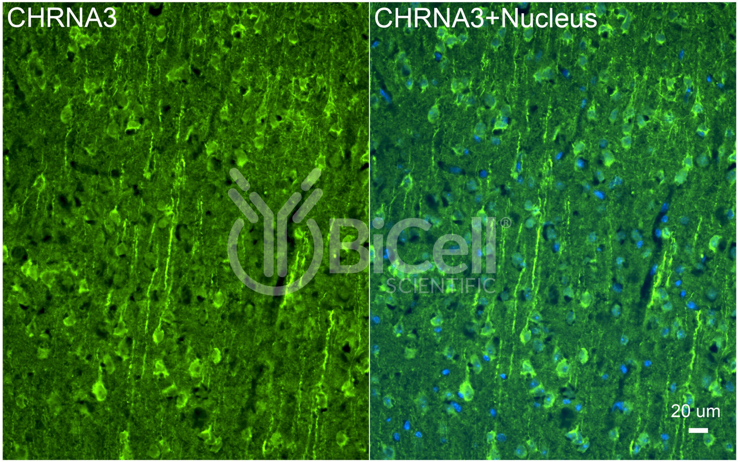 CHRNA3 (NACHRA3) Antibody - FFPE Validated