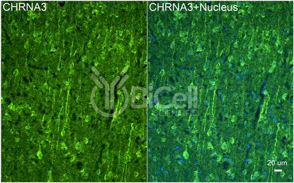 CHRNA3 (NACHRA3) Antibody