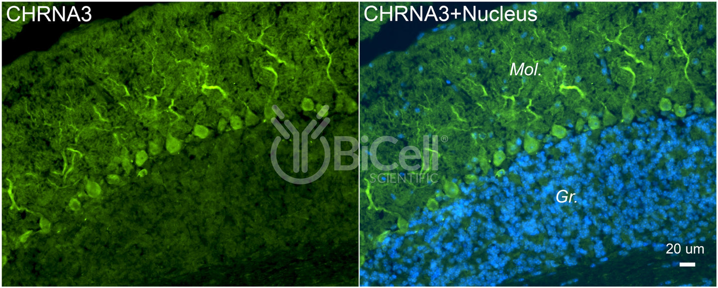 CHRNA3 (NACHRA3) Antibody - FFPE Validated