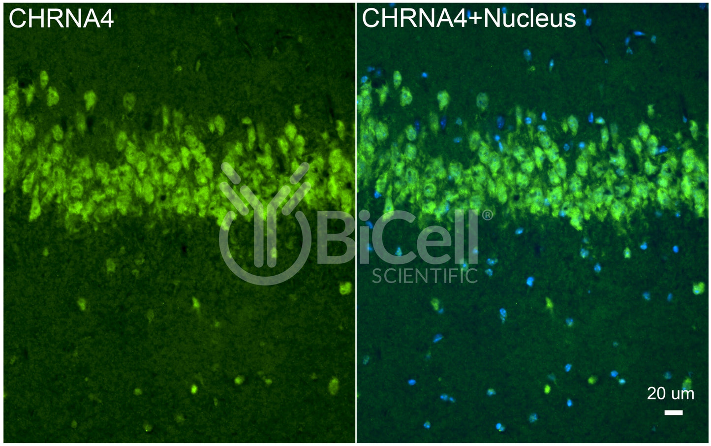 CHRNA4 (NACHRA4) Antibody - FFPE Validated