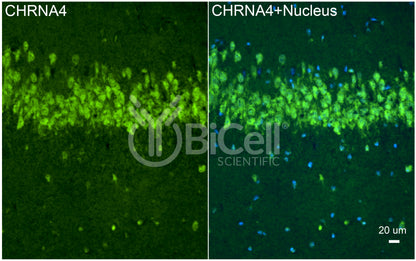 CHRNA4 (NACHRA4) Antibody - FFPE Validated