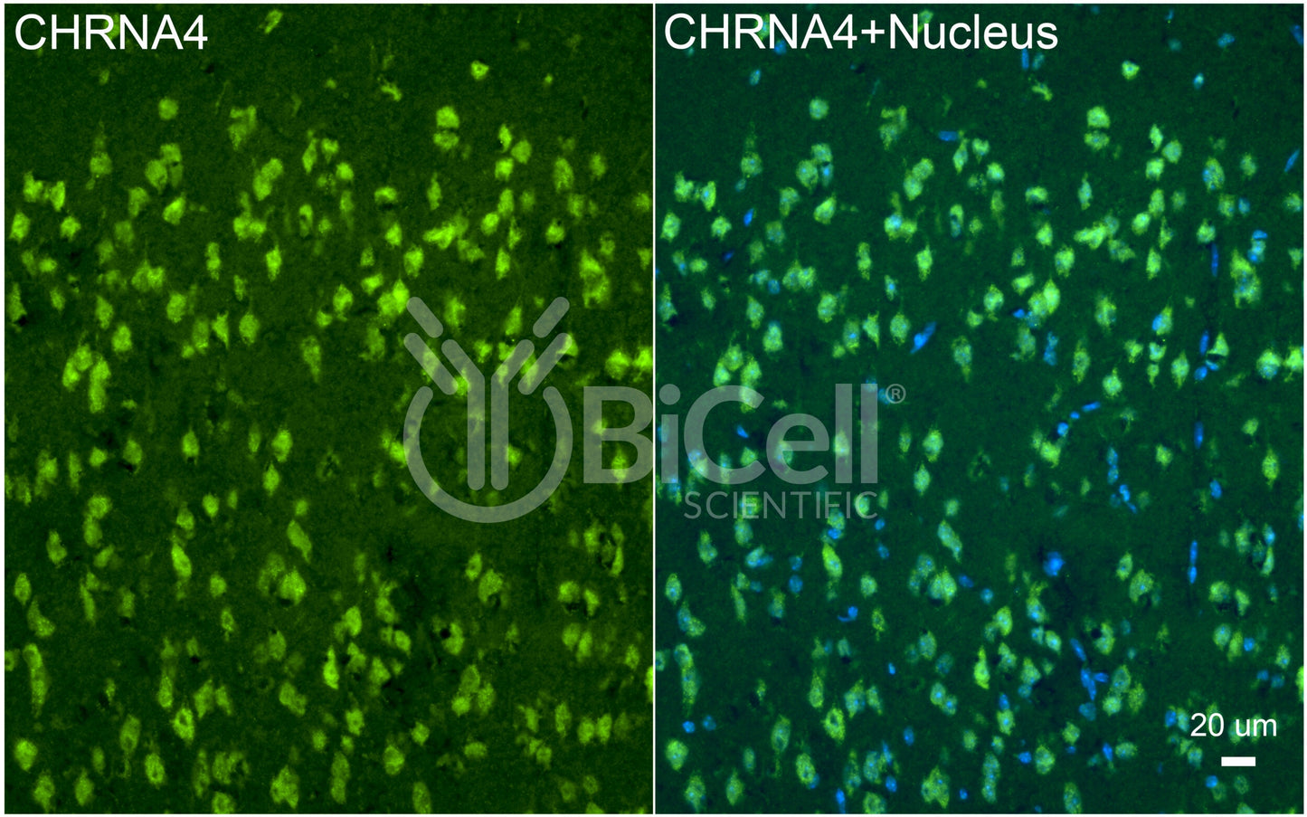 CHRNA4 (NACHRA4) Antibody - Western Blot Validated