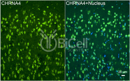 CHRNA4 (NACHRA4) Antibody - Western Blot Validated