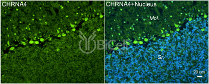 CHRNA4 (NACHRA4) Antibody - Western Blot Validated