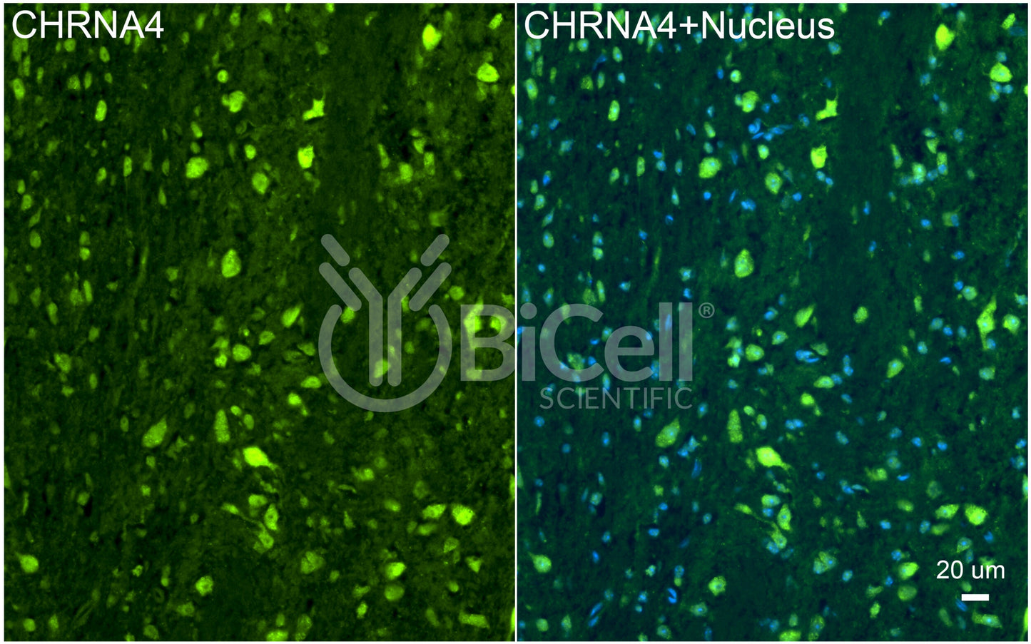 CHRNA4 (NACHRA4) Antibody - FFPE Validated