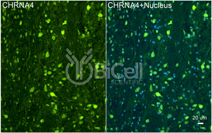 CHRNA4 (NACHRA4) Antibody - FFPE Validated