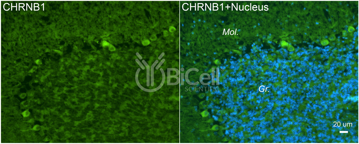 CHRNB1 (ACHRB) Antibody - FFPE Validated