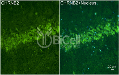 CHRNB2 (nAChRB2) Antibody - Western Blot Validated